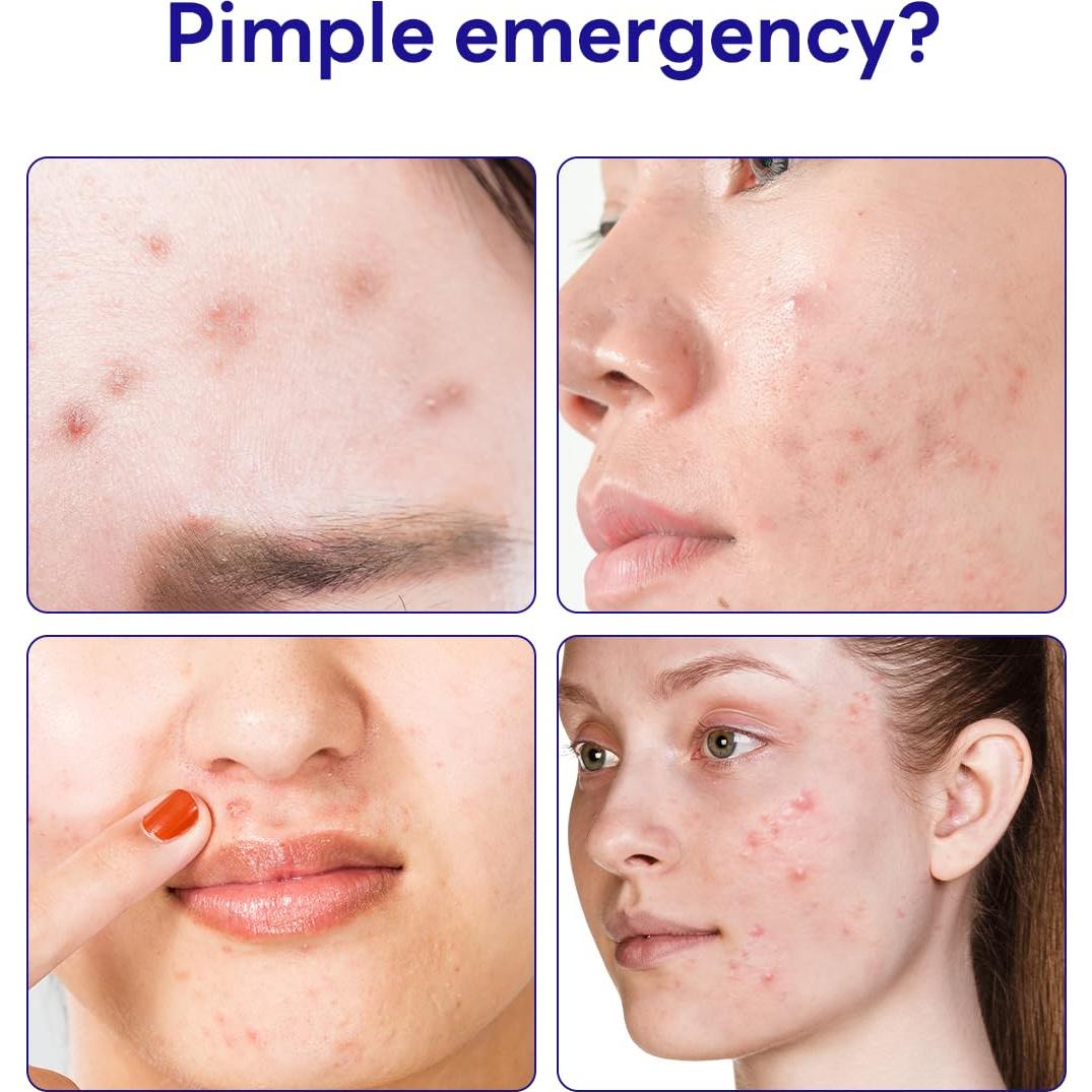 Parche Hidrocoloide Mediheal Madecassoside 44 Unidades - Acné