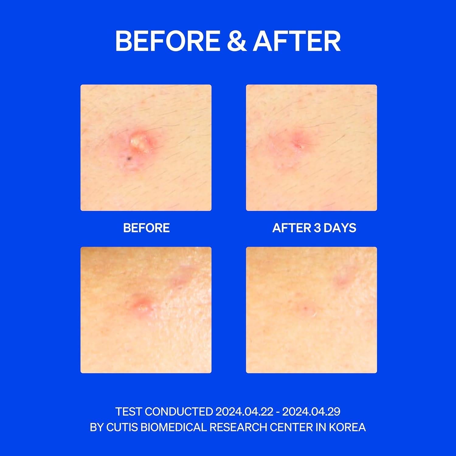 Parche Hidrocoloide Thincognito Skin Squared - 42 Unidades