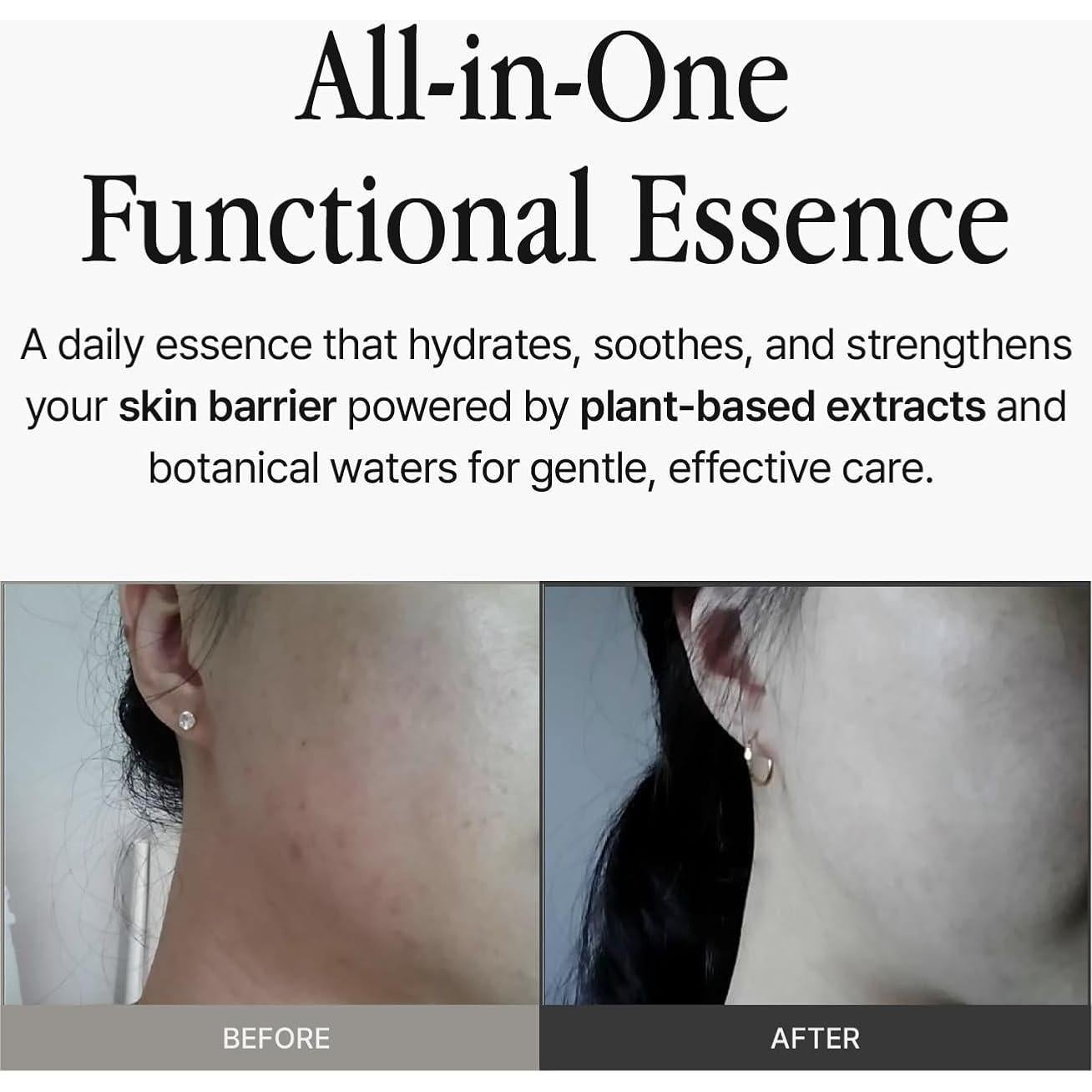 Essence Hidratante 40ml Barinu - Extracto de Hamamelis