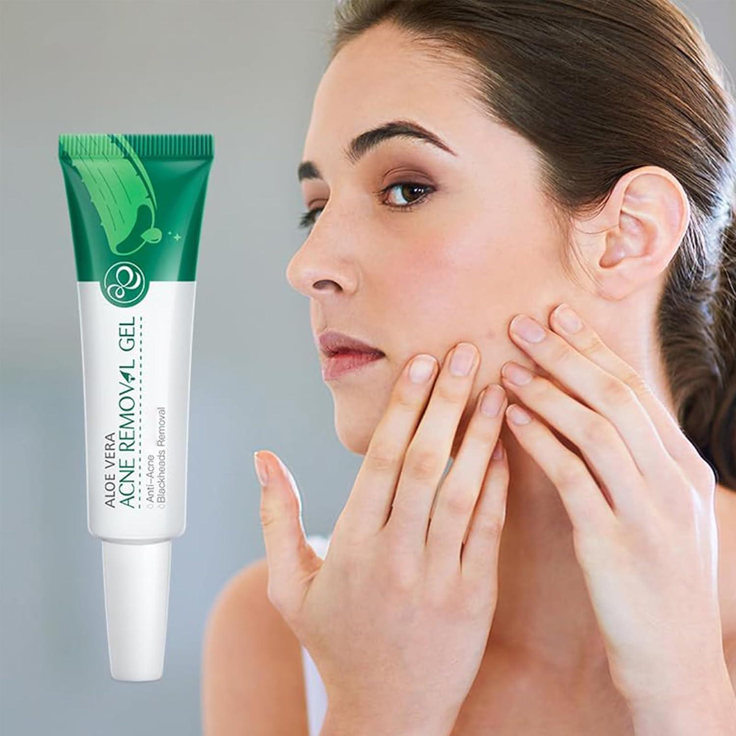 Gel de Aloe Vera Orgánico MIESCHER 68g Hidratante Facial y Corporal
