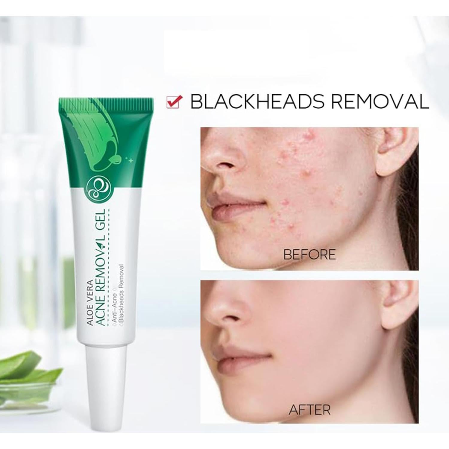 Gel de Aloe Vera Orgánico MIESCHER 68g Hidratante Facial y Corporal