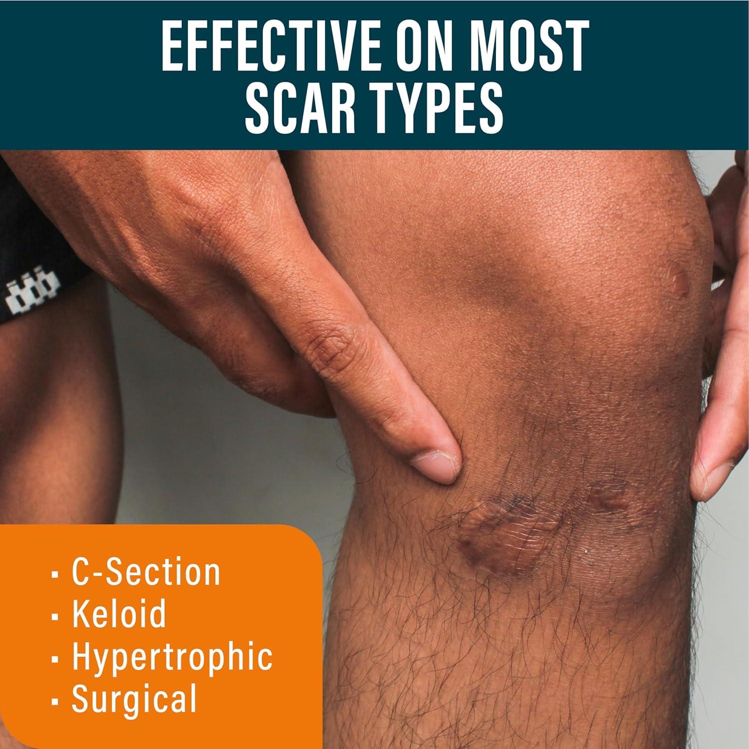 Gel para Cicatrices NUVADERMIS con Retinol y Alantoína - 48 g