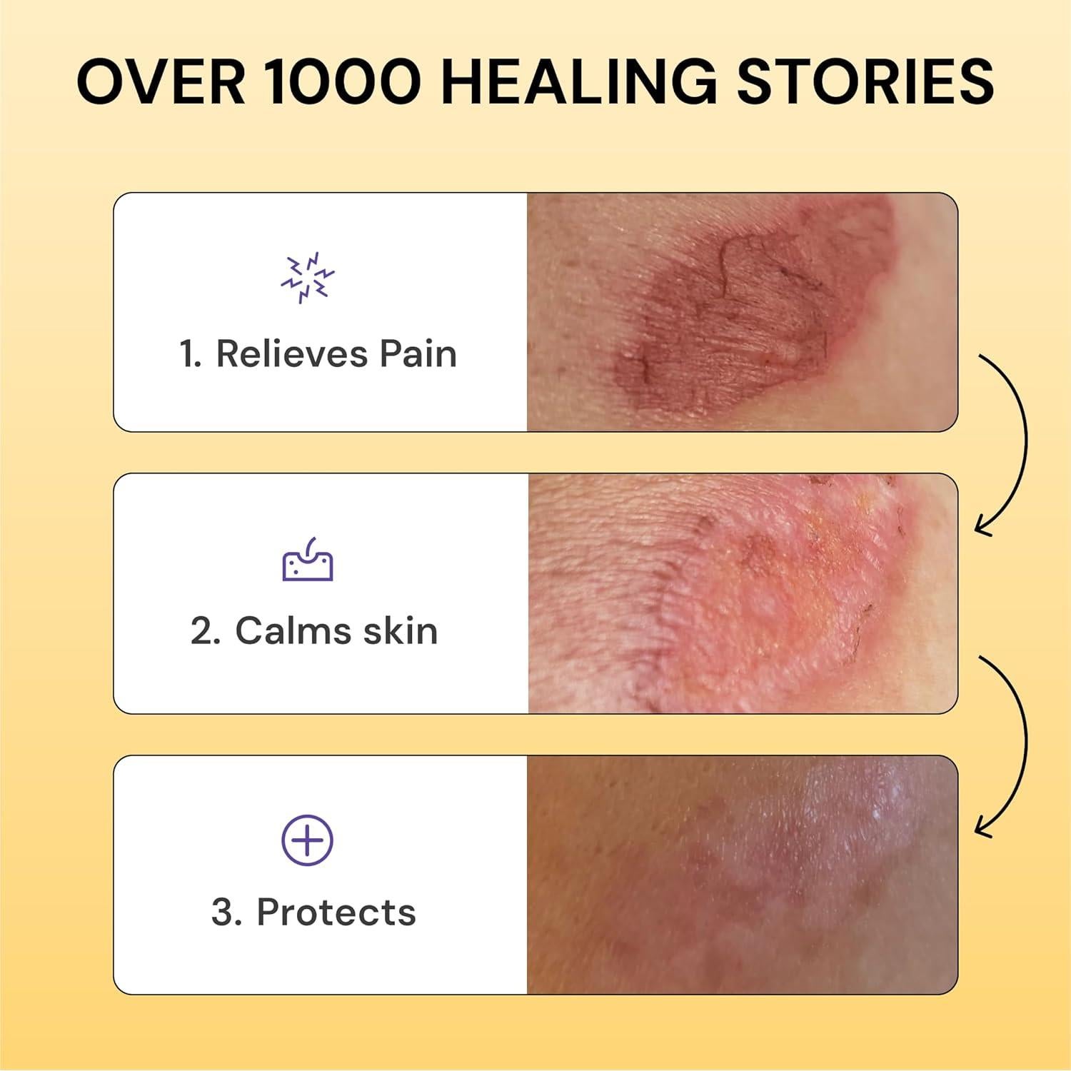 Cuidado Universal de Brotes MyMagicHealer 28.35g Alivio Eccema