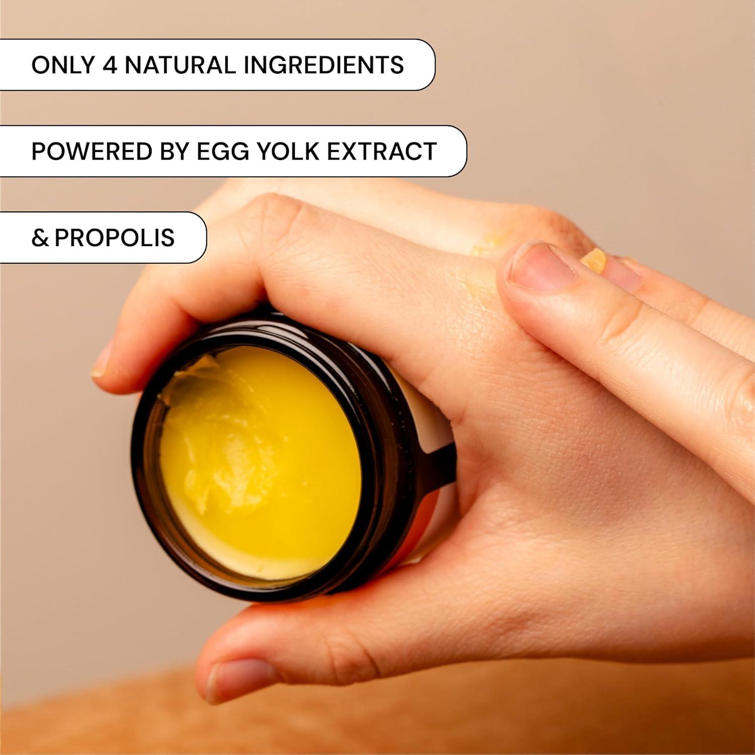 Cuidado Universal de Brotes MyMagicHealer 28.35g Alivio Eccema