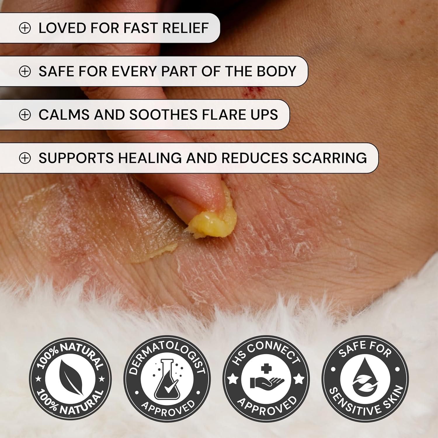 Cuidado Universal de Brotes MyMagicHealer 28.35g Alivio Eccema