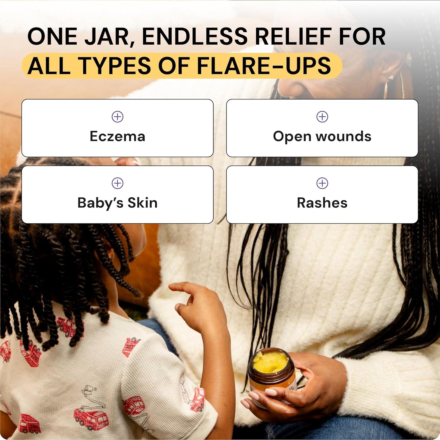 Cuidado Universal de Brotes MyMagicHealer 28.35g Alivio Eccema