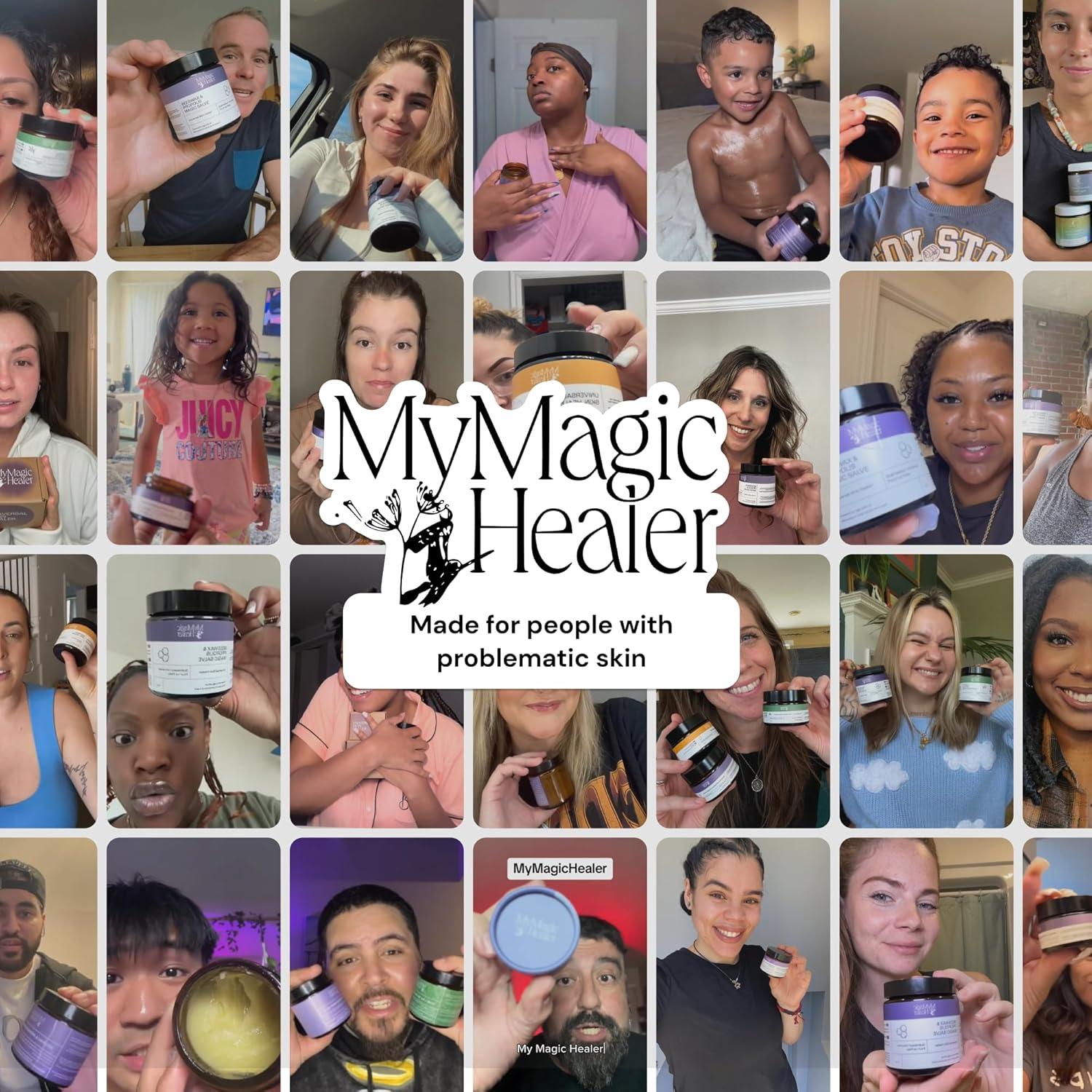 Cuidado Universal de Brotes MyMagicHealer 28.35g Alivio Eccema