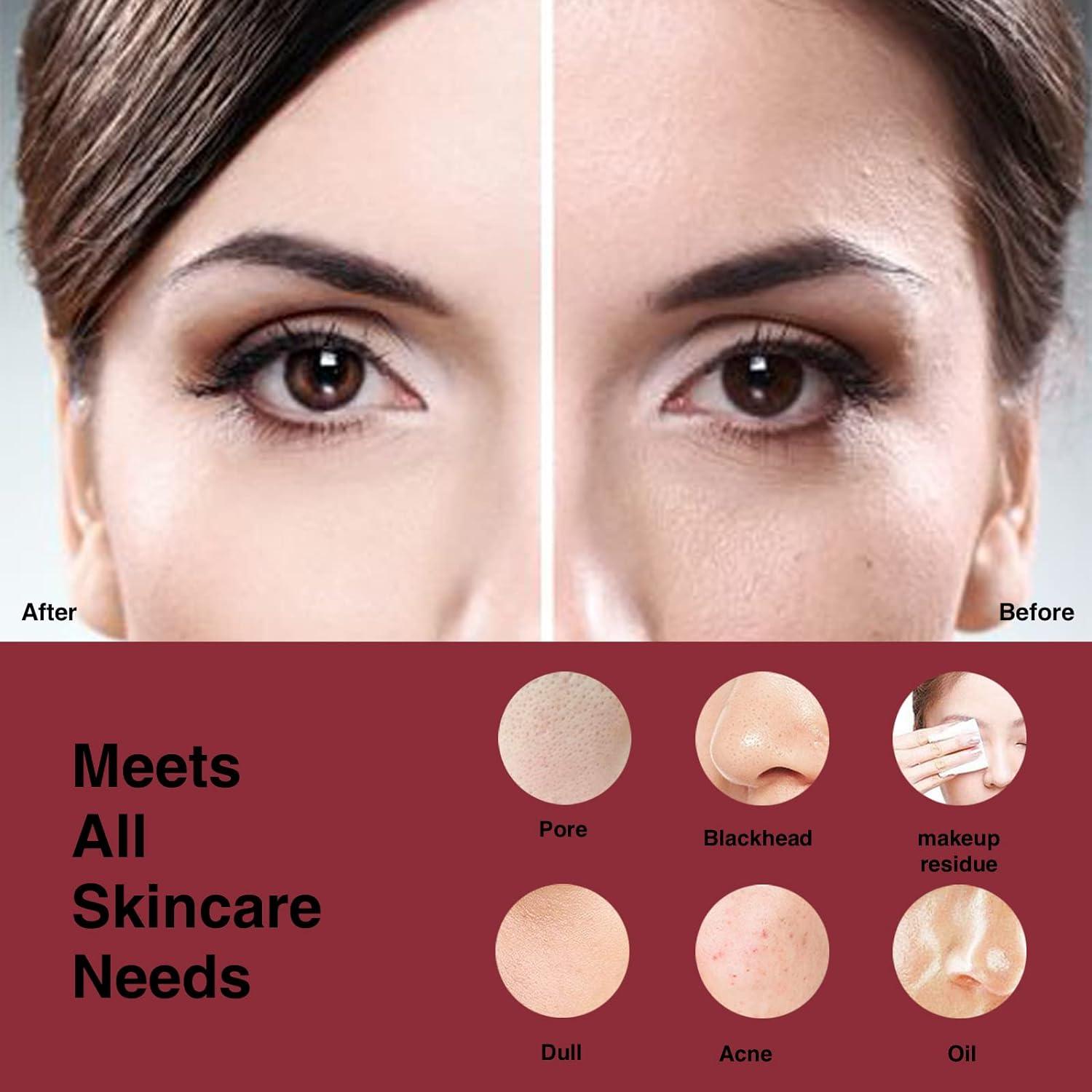 Cepillo Facial Limpiador NagraCoola N11 Recargable Berry