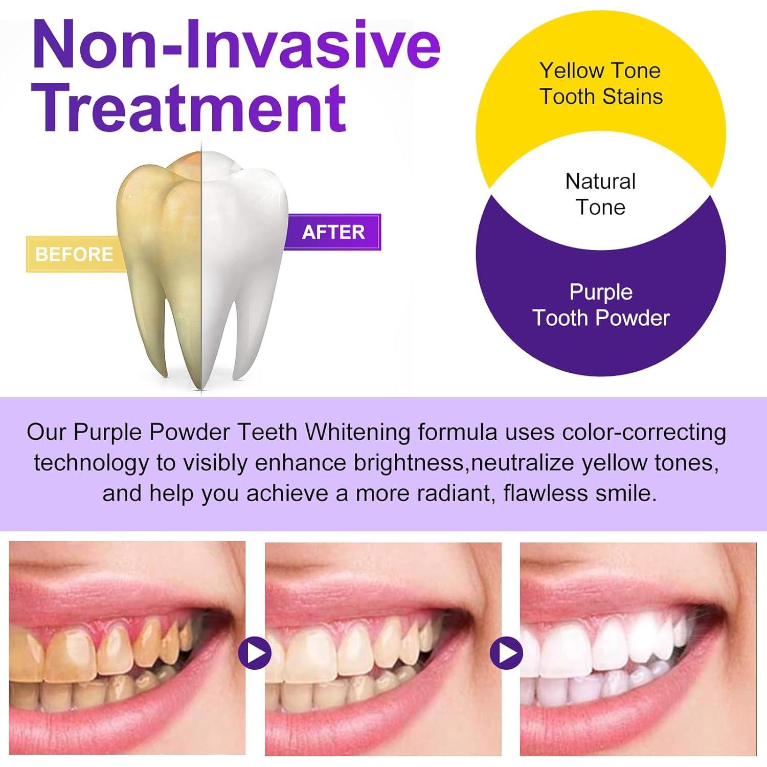 Polvo Blanqueador de Dientes Nature Ziran 15g - Sin Sensibilidad