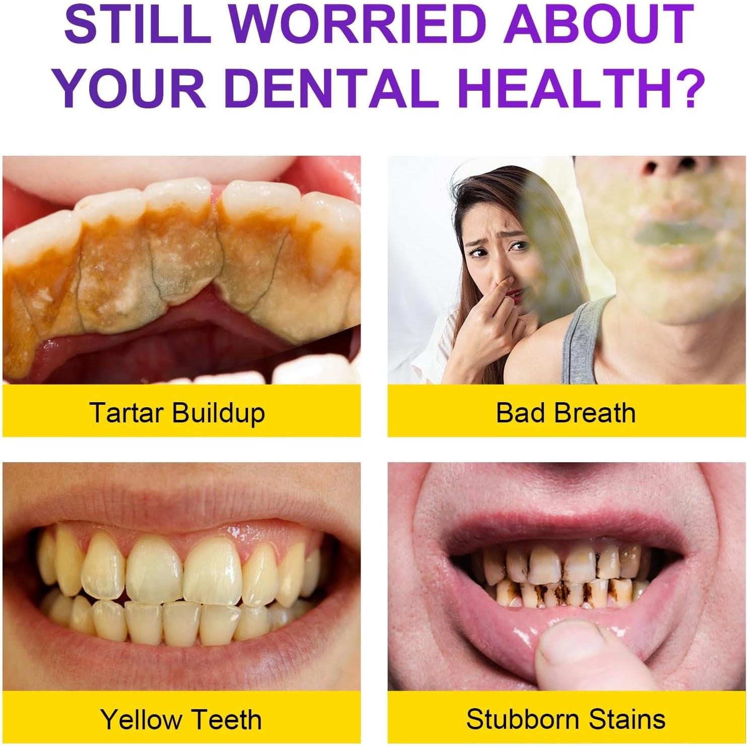 Polvo Blanqueador de Dientes Nature Ziran 15g - Sin Sensibilidad