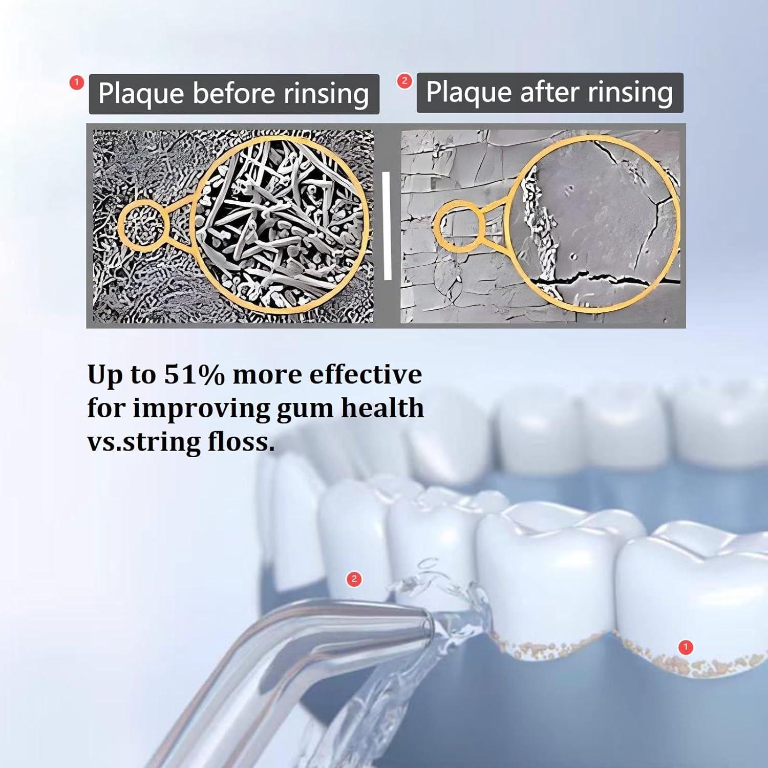 Puntas de Reemplazo para Irrigador Bucal WaterPik - 3 Clásicas