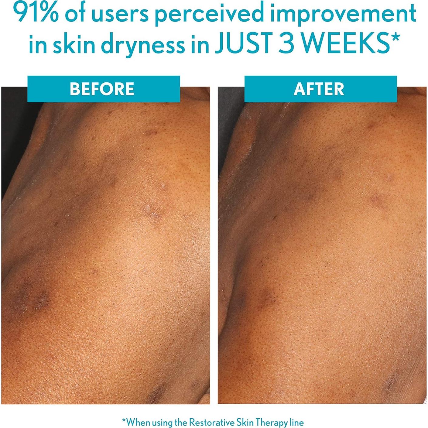 Crema Reparadora Hidratante Aveeno 56.7g para Piel Sensible