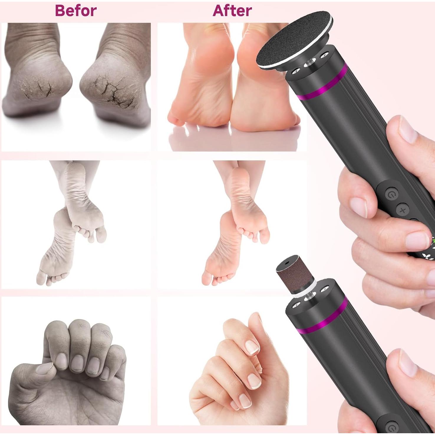 Removedor de Callos Eléctrico Dermave 2 en 1 Inalámbrico Gris