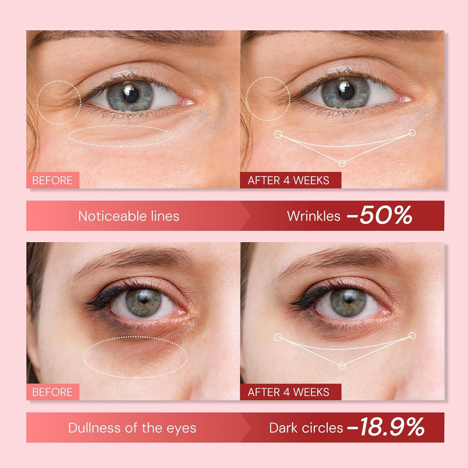 Crema para Ojos Anti-Envejecimiento EnaSkin 25.4 ml Retinol