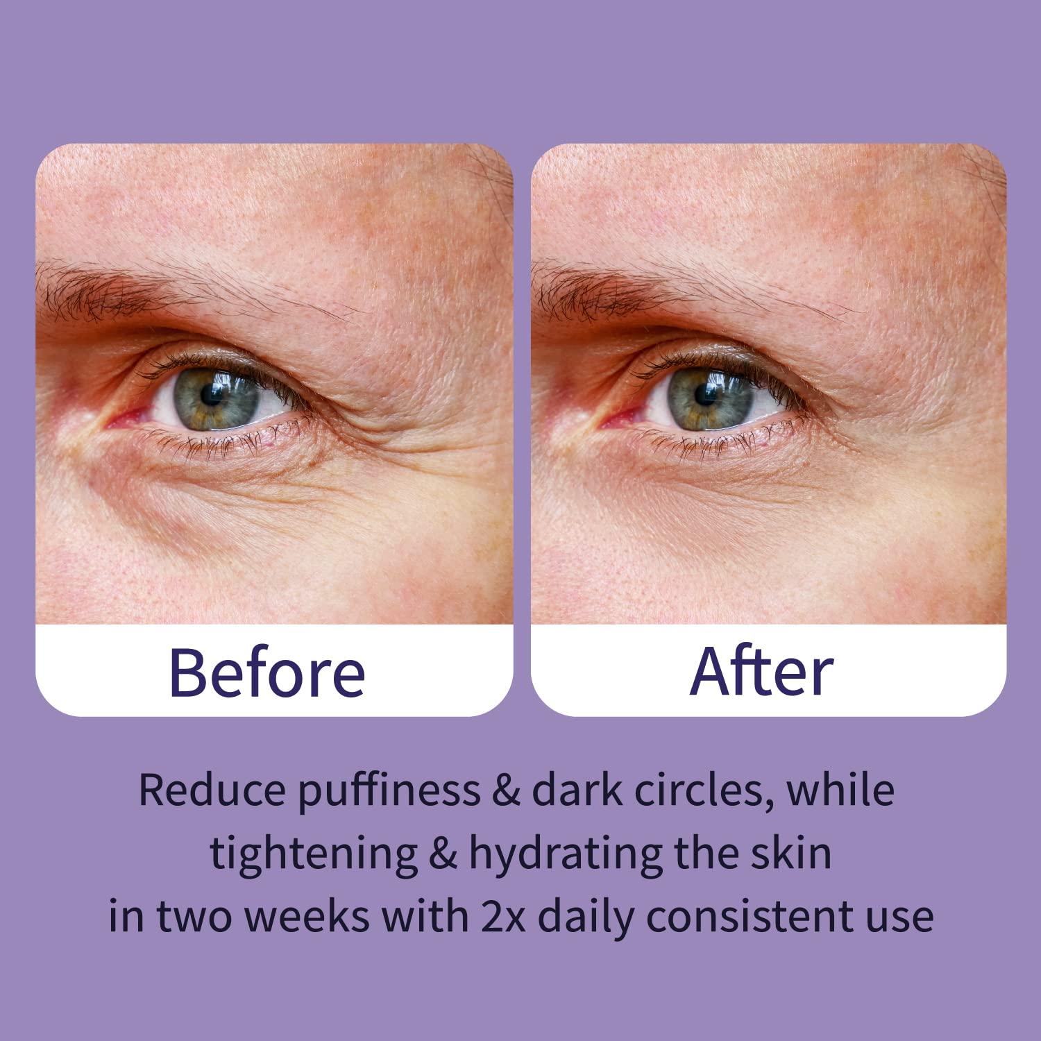 Suero para los Ojos Ebanel 15ml con Péptidos y Extractos