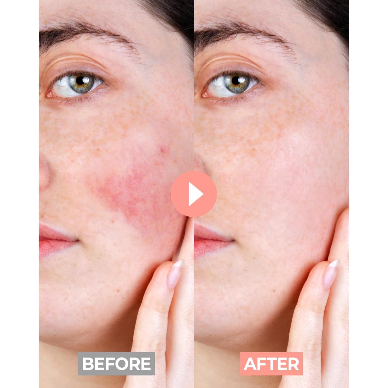 Crema Frutal KOLMAR para Piel Sensible 200ml - Hidratante Hipoalergénico