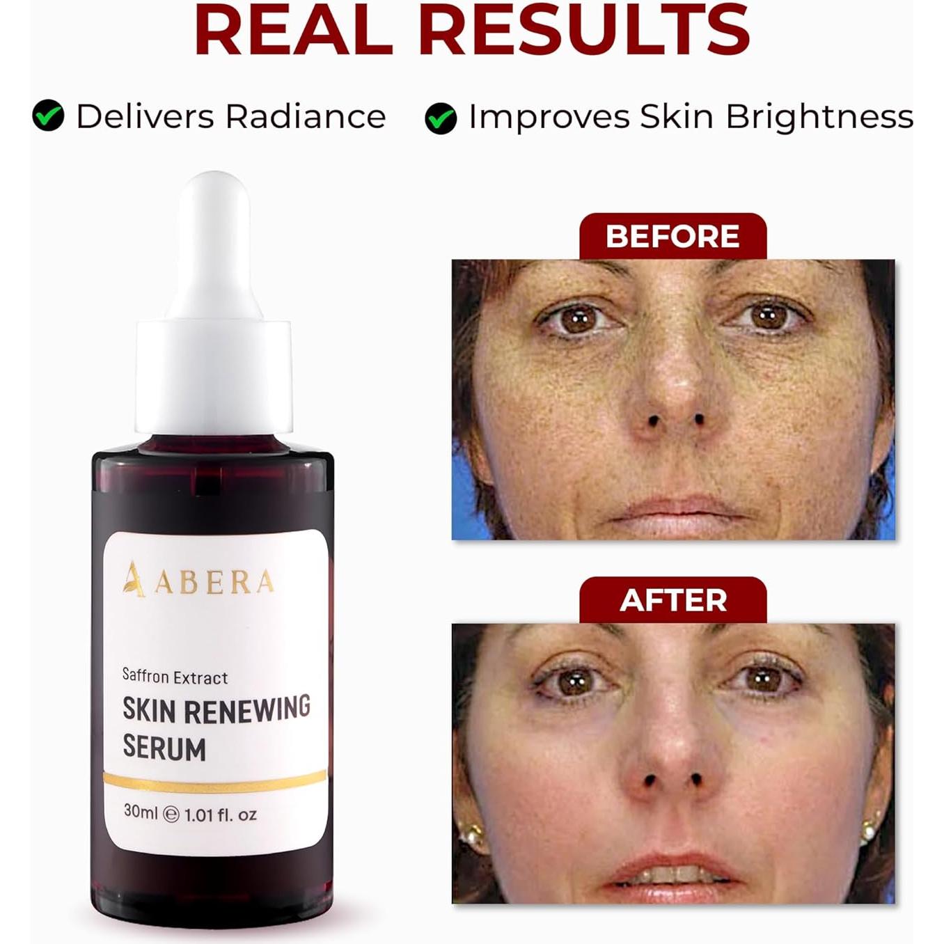 Suero Antienvejecimiento ABERA 30 ml - Tratamiento Melasma