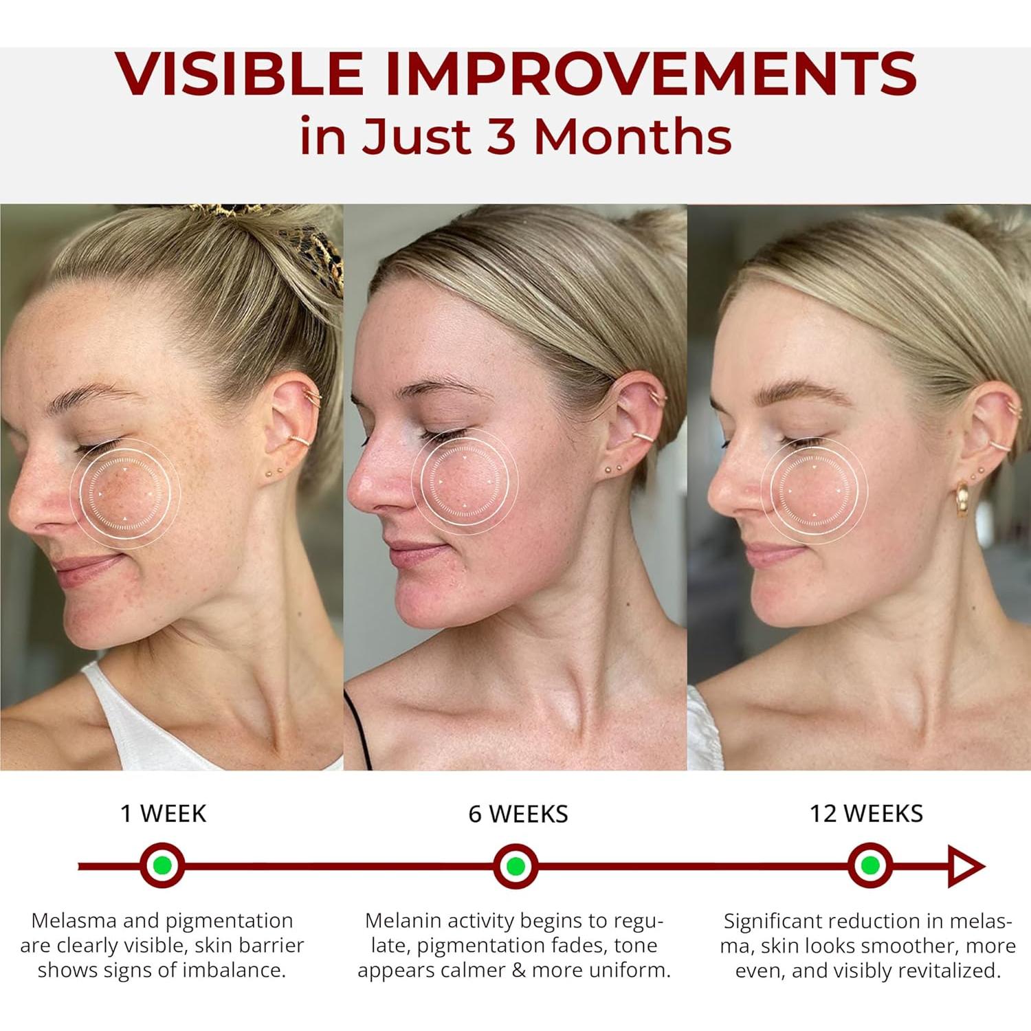 Suero Antienvejecimiento ABERA 30 ml - Tratamiento Melasma