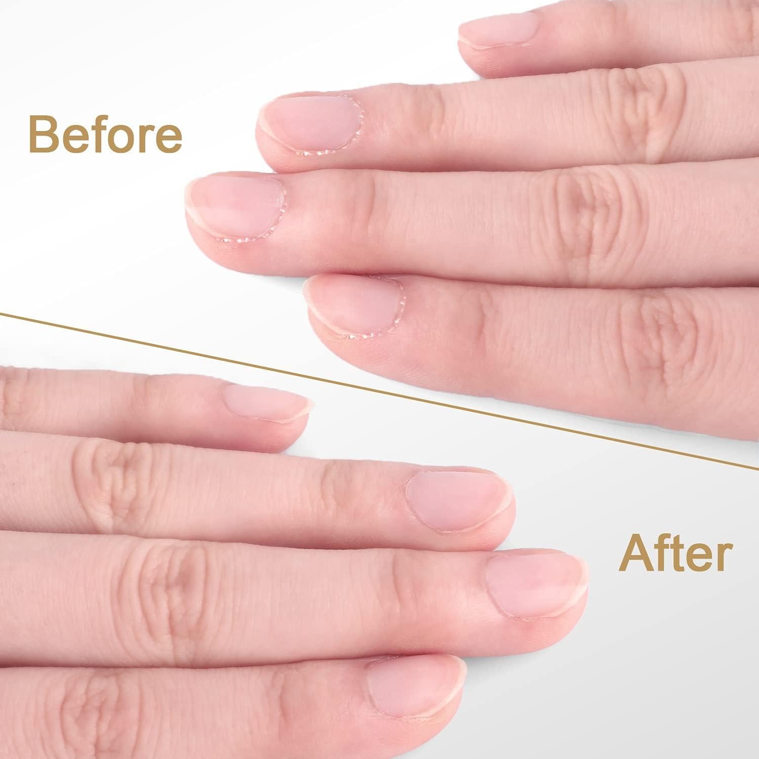 Recortador de Cutículas Easkep Profesional Acero Inoxidable