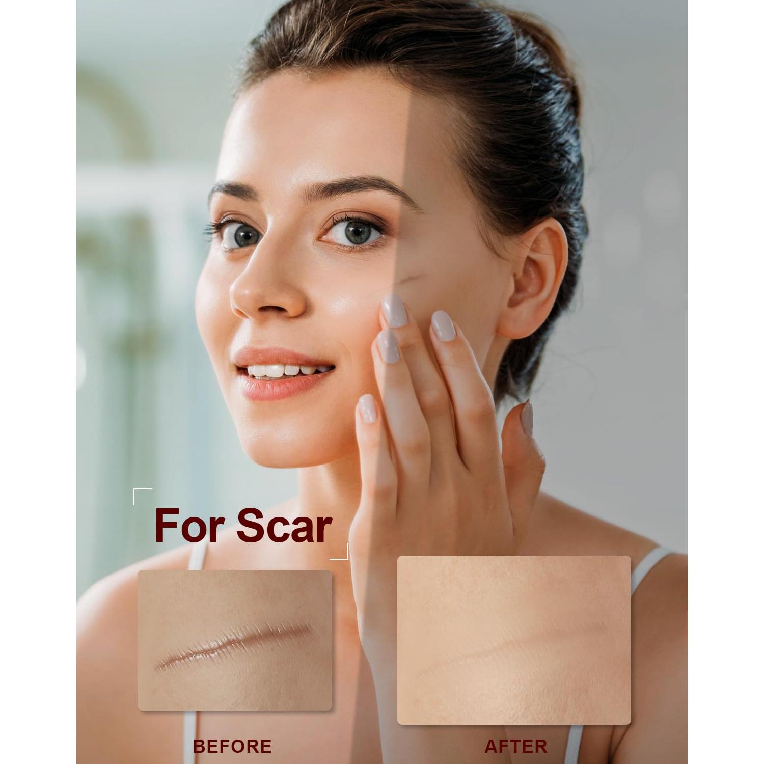 Organic Rosehip Seed Oil for Face,100% USDA Pure Rosehip Oils for Skin,Scars,Hair & Nails.2 fl Oz Cold Pressed Rose HIPS Oils for Skin Care, Anti-Aging, Scar Treatment, GUA SHA Massage Carrier Oil