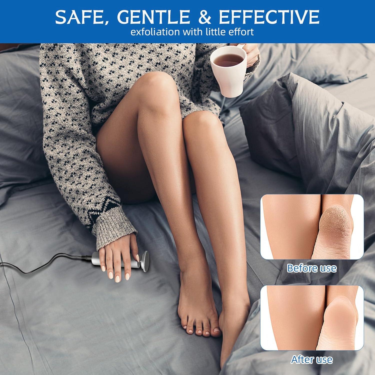 Removedor de Callos Eléctrico Dermave con 60 Discos - Plata