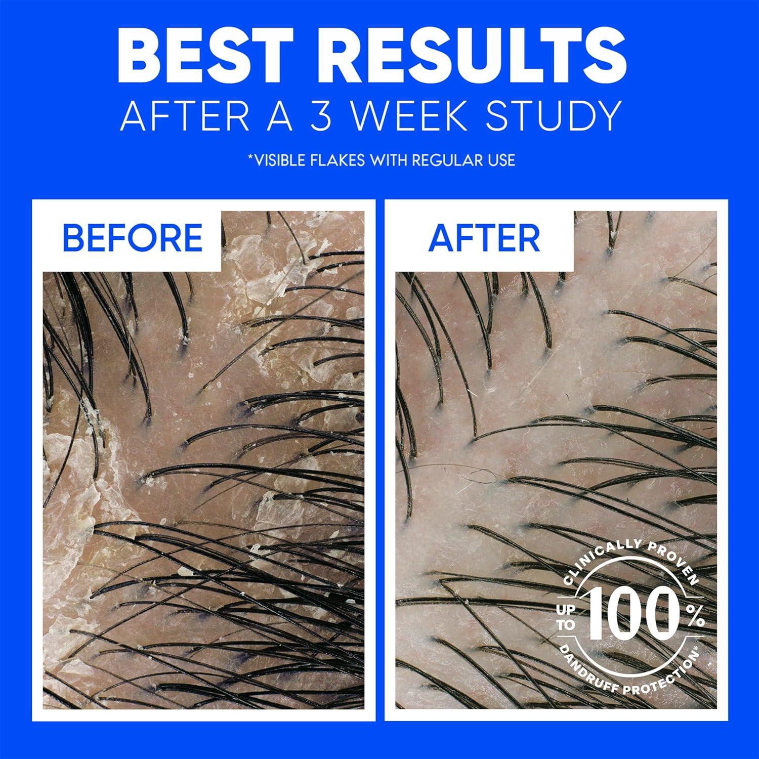 Champú Anticaspa Head & Shoulders Classic Clean 2x32.1 Oz