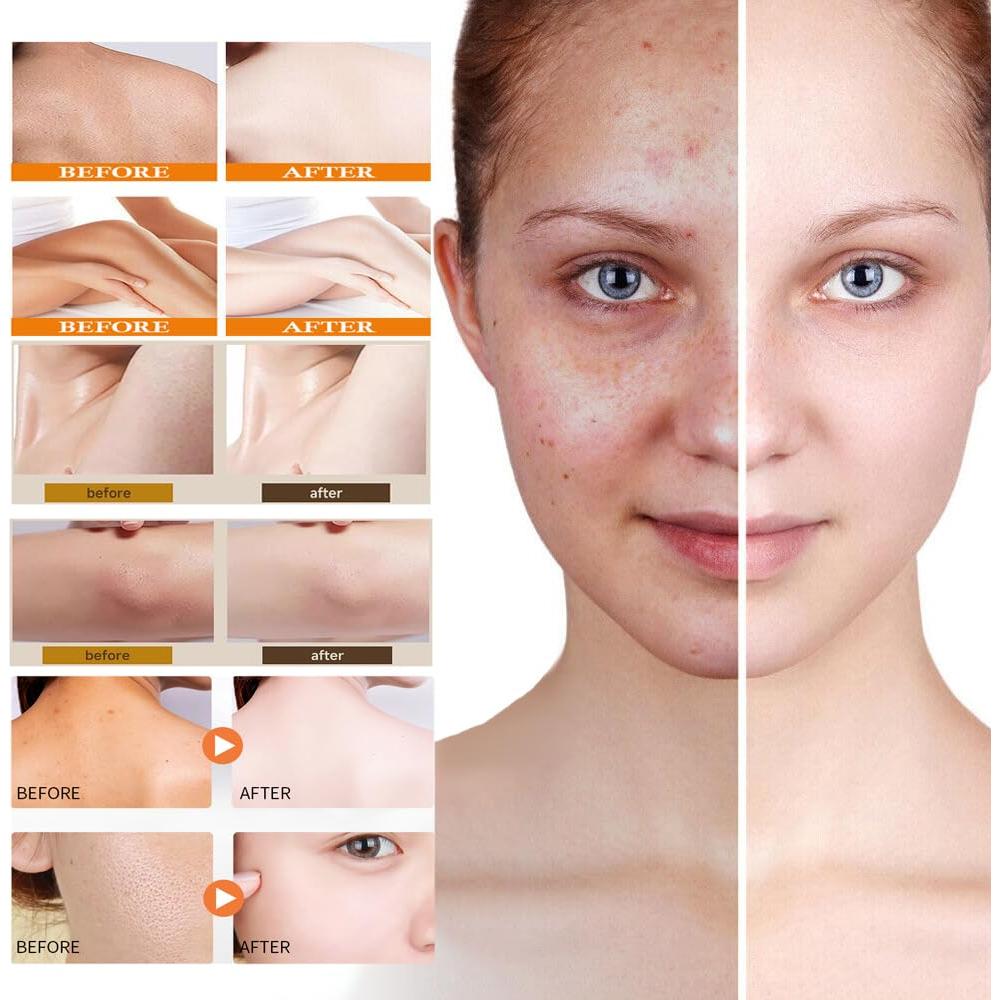 Juego de Jabón y Limpiador Facial Derperzi con Cepillo