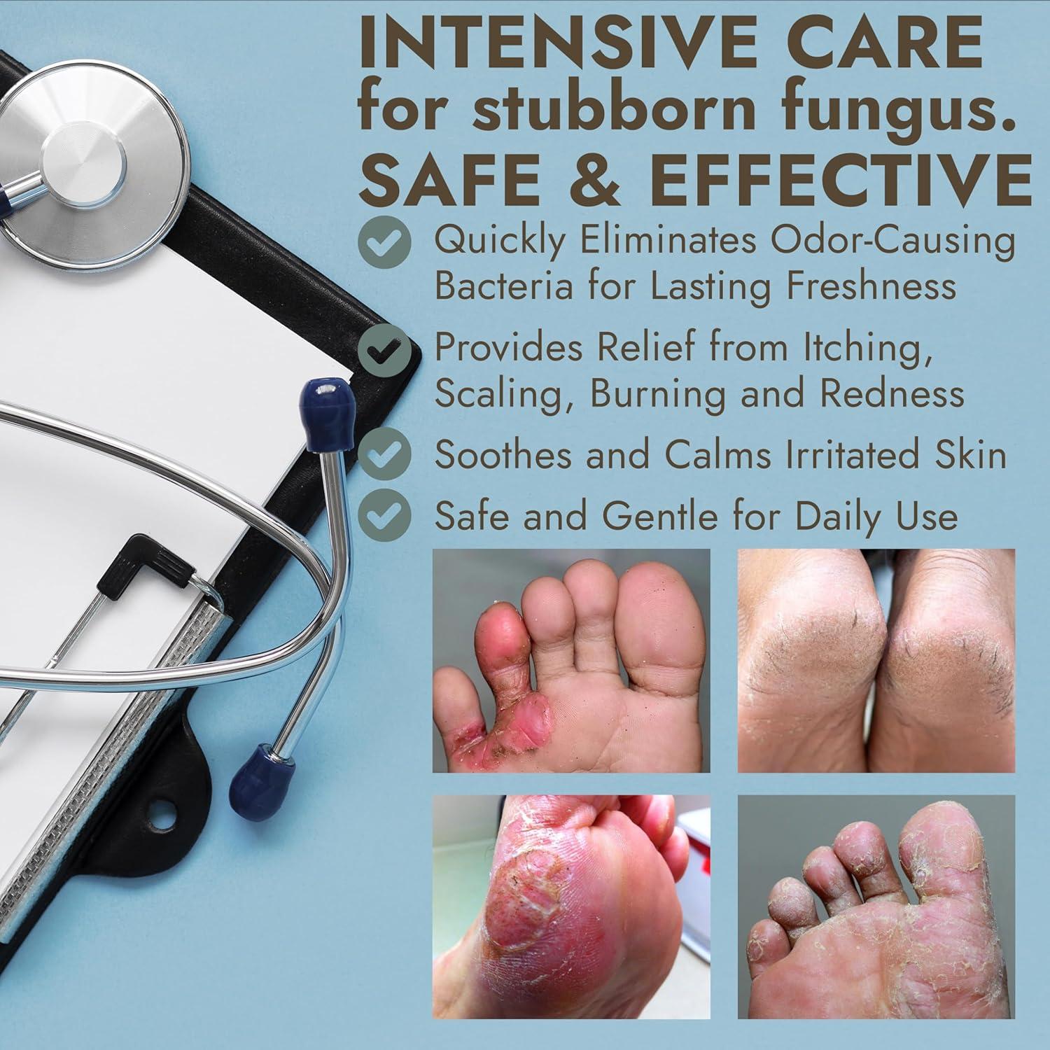 Crema para Pies FUNGAZOL 118 ml - Antifúngica con Aceite de Árbol de Té