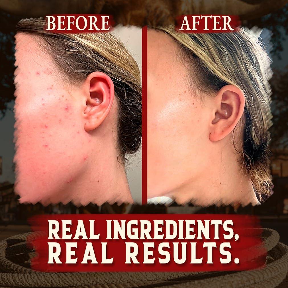 Grasa de Res Orgánica Wrath & Remedy - 3 x 113.4 g - Hidratante