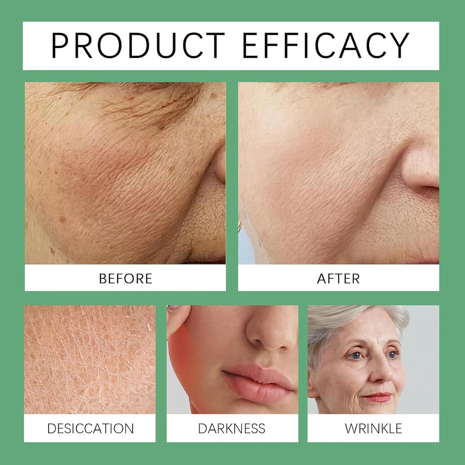 Parche Reafirmante TLOPA Nano SMGT-GLP-1 con Jengibre 1ud