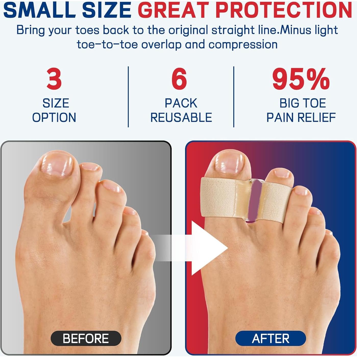 Separadores de Dedos Grandes FULEEAN - Corrector de Juanetes Beige XS