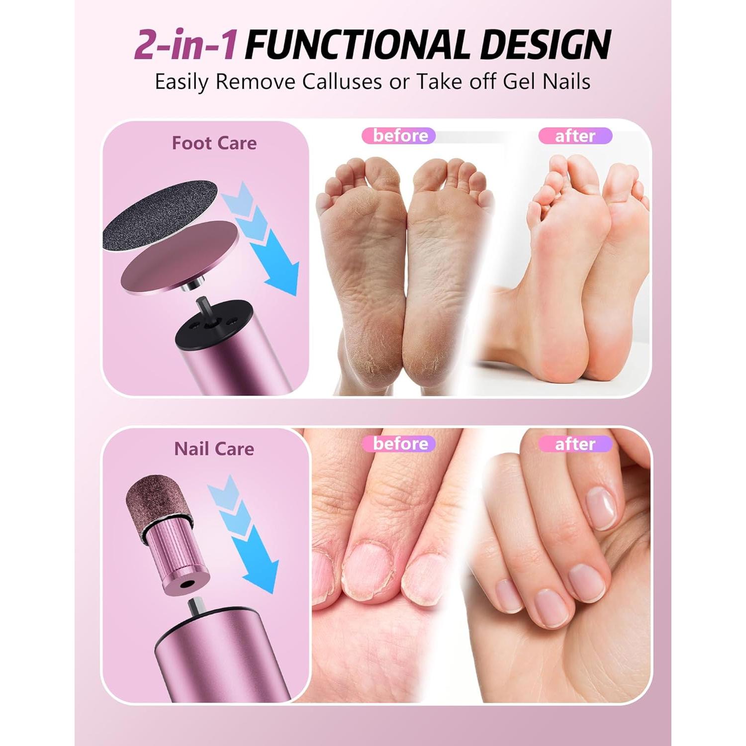 Removedor de Callos Eléctrico K KERNOWO 2-en-1 Recargable 9 Velocidades