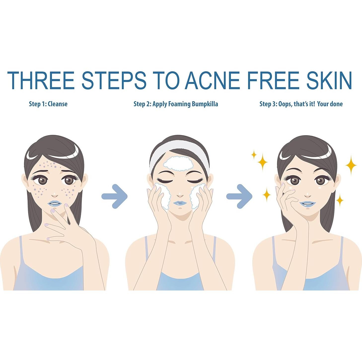 Tratamiento Acné BumpKilla - 80% Menos Acné en 4 Semanas