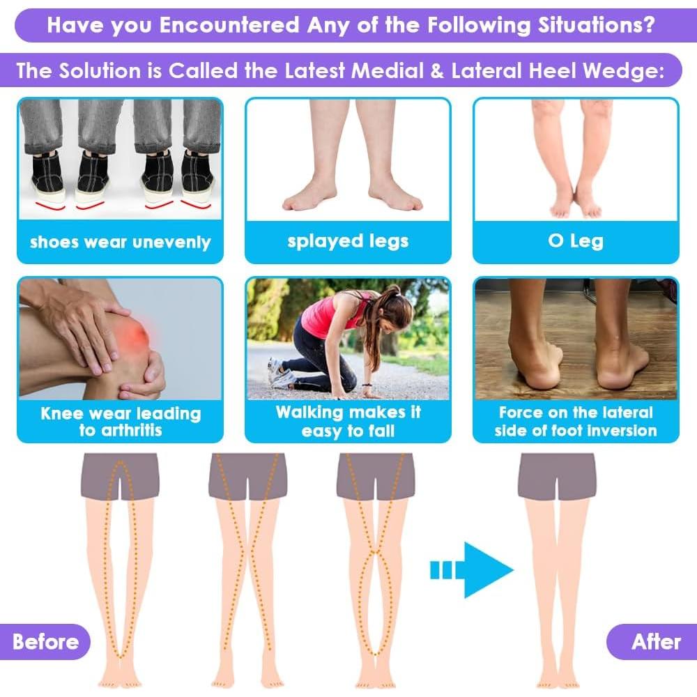 Plantillas Ajustables Antideslizantes Svowin para Supinación y Pronación - Beige, Talla S (W 4-7.5 / M 6-7)