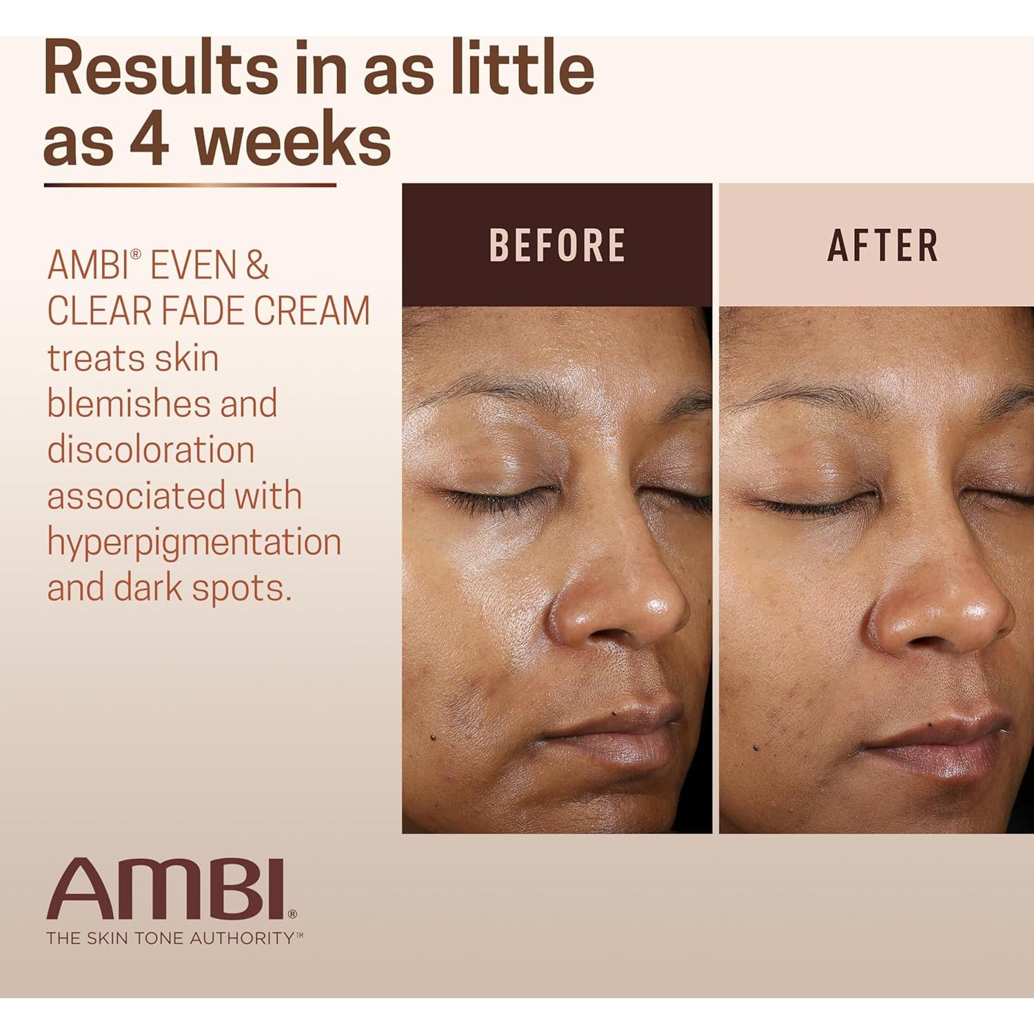 Crema Desvanecedora Ambi Even & Clear 29.57 ml - Hiperpigmentación