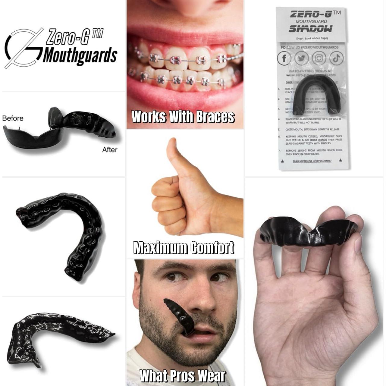 Protector Bucal Zero-G Adulto Negro - Ultra Delgado y Ligero