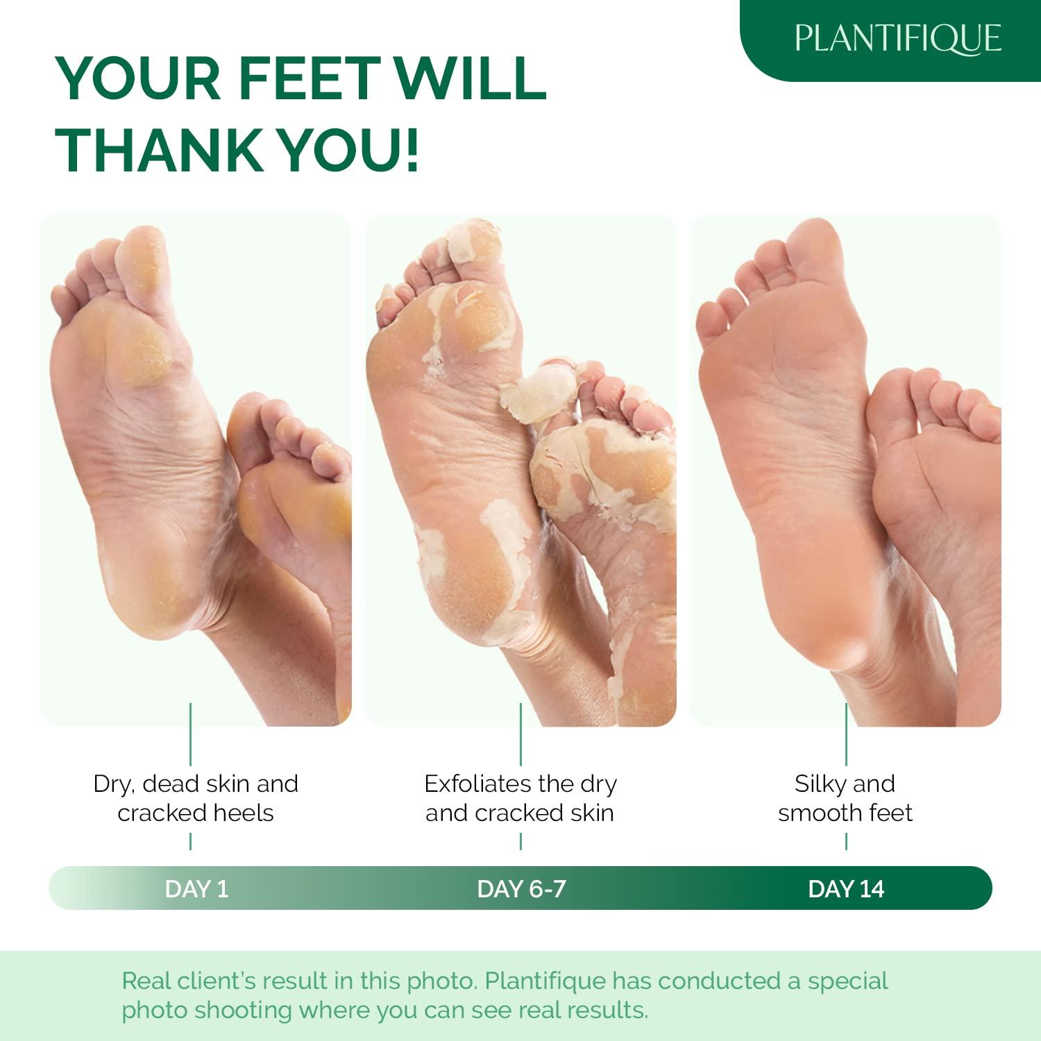 Mascarilla Exfoliante para Pies Plantifique Aloe Vera 2 Paquetes