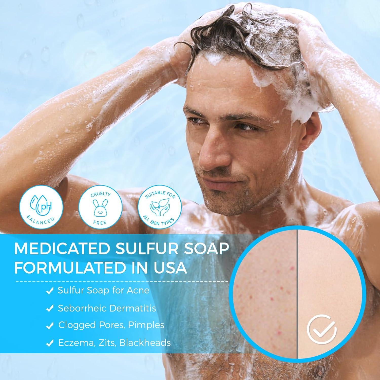 Jabón de Azufre OUKEYA 10% para Acné 114g - Tratamiento Facial