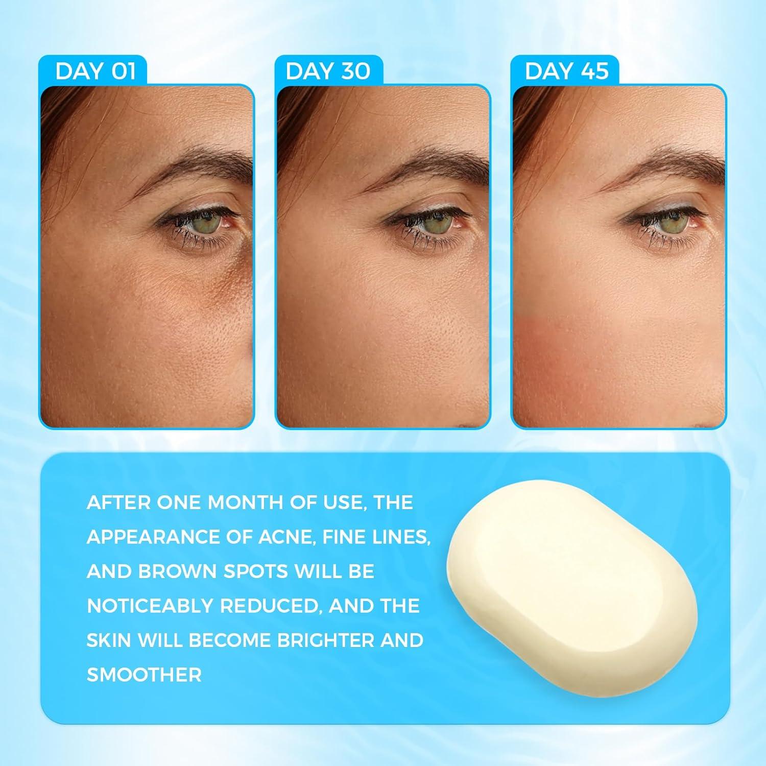 Jabón de Azufre OUKEYA 10% para Acné 114g - Tratamiento Facial