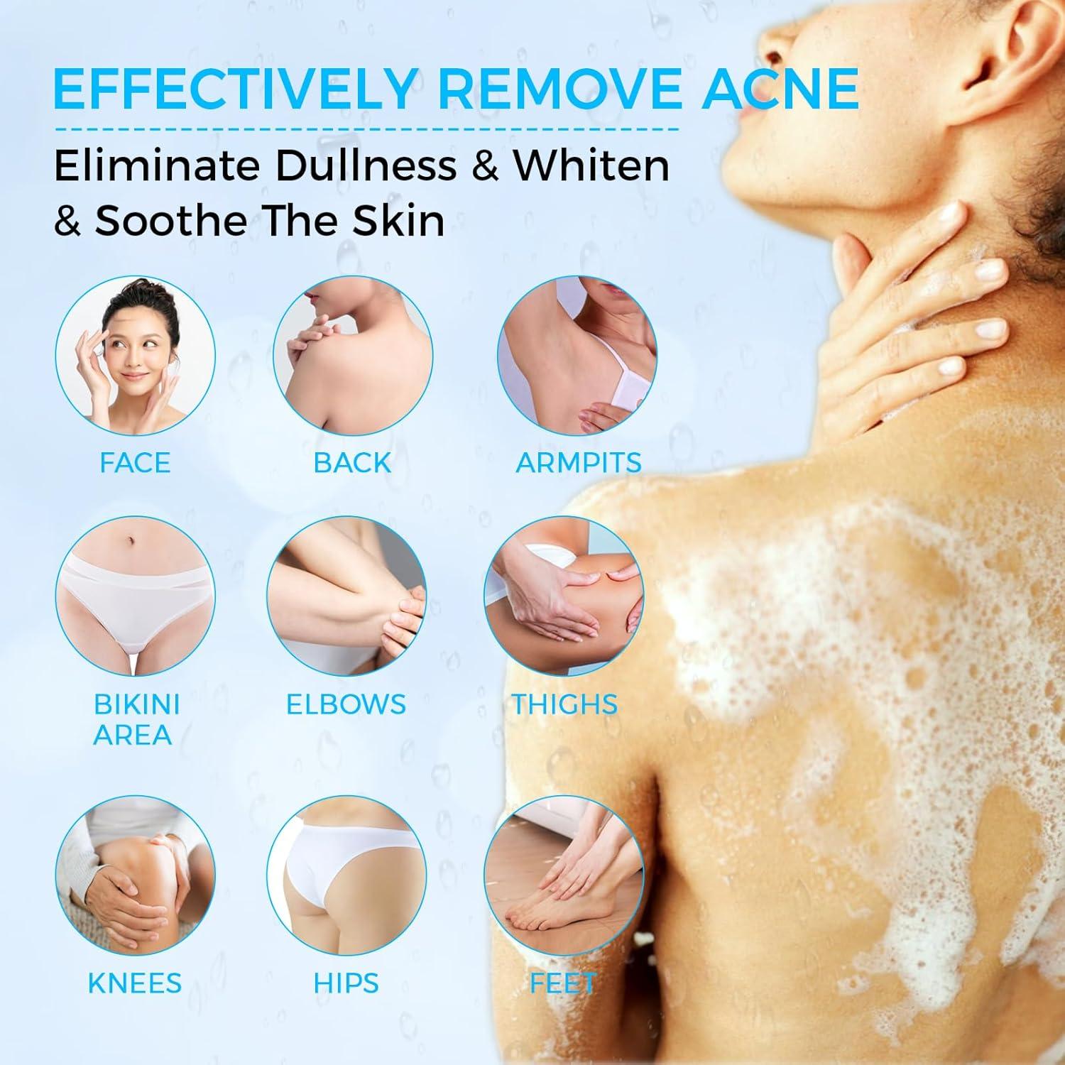 Jabón de Azufre OUKEYA 10% para Acné 114g - Tratamiento Facial