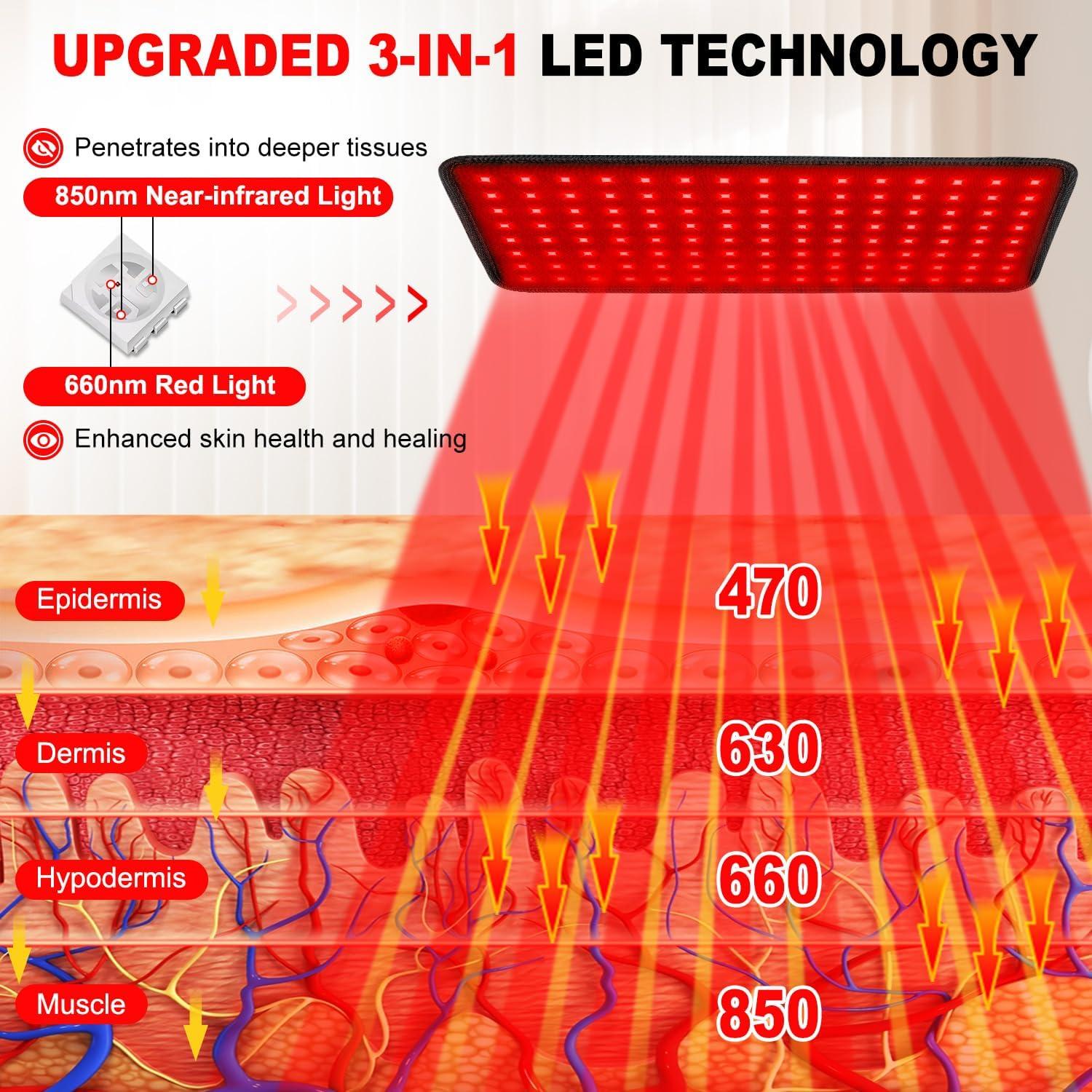 Cinturón de Terapia de Luz Roja Myipyi 40x20cm 660nm 850nm