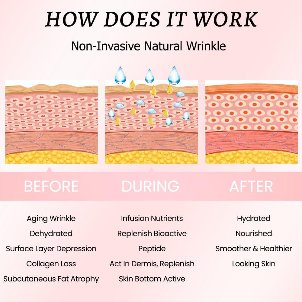 Cintas Médicas Faciales para Arrugas evpct 256 Pcs - Silicona