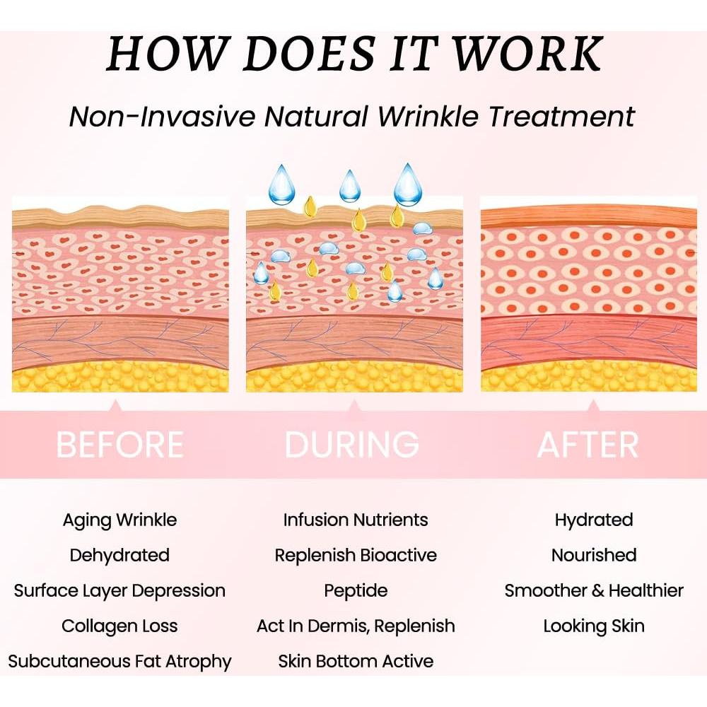 Cinta Facial Reutilizable Evpct 32 Pcs para Arrugas Nocturnas