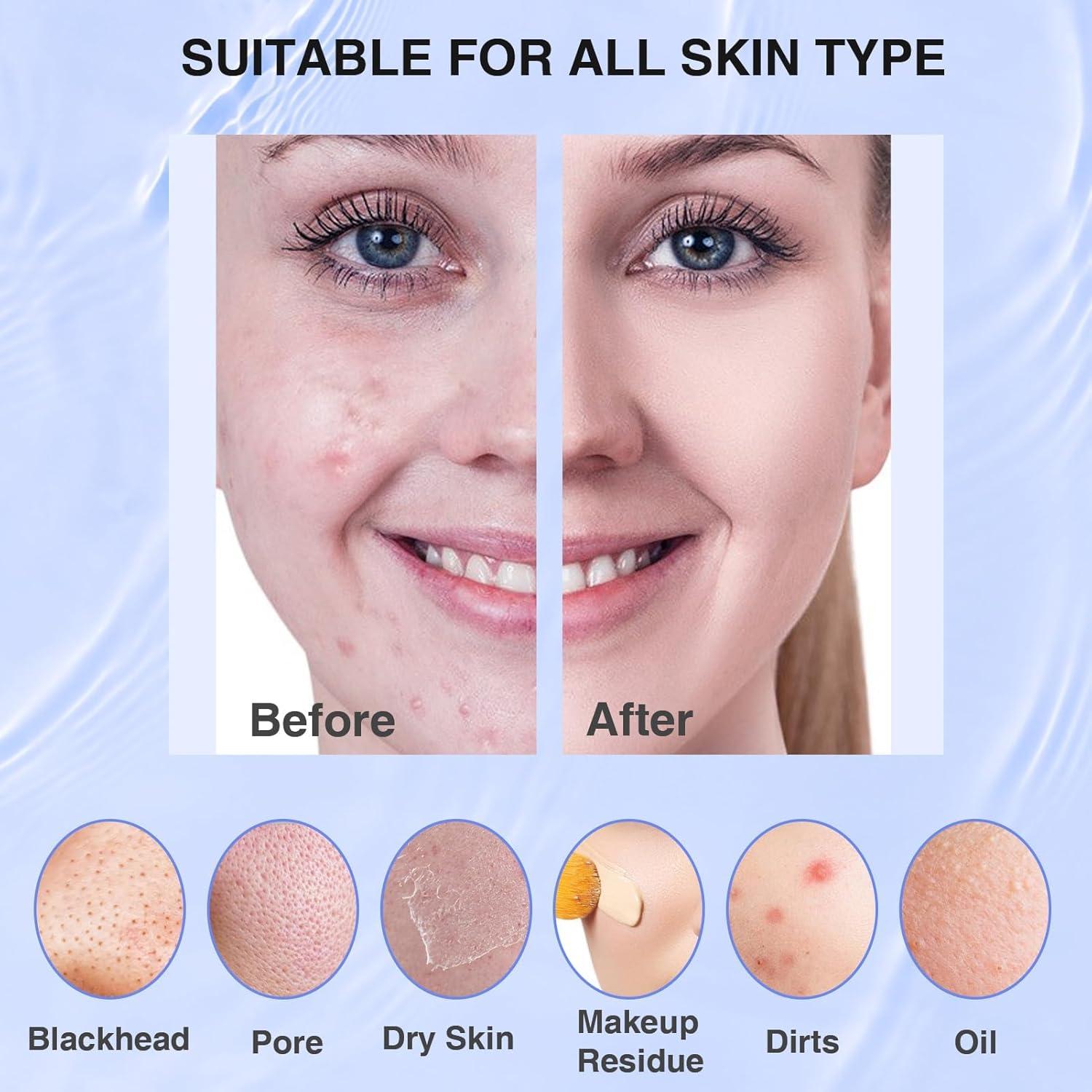 Exfoliador Facial Eléctrico Mosnami SK-0308 Azul IPX7