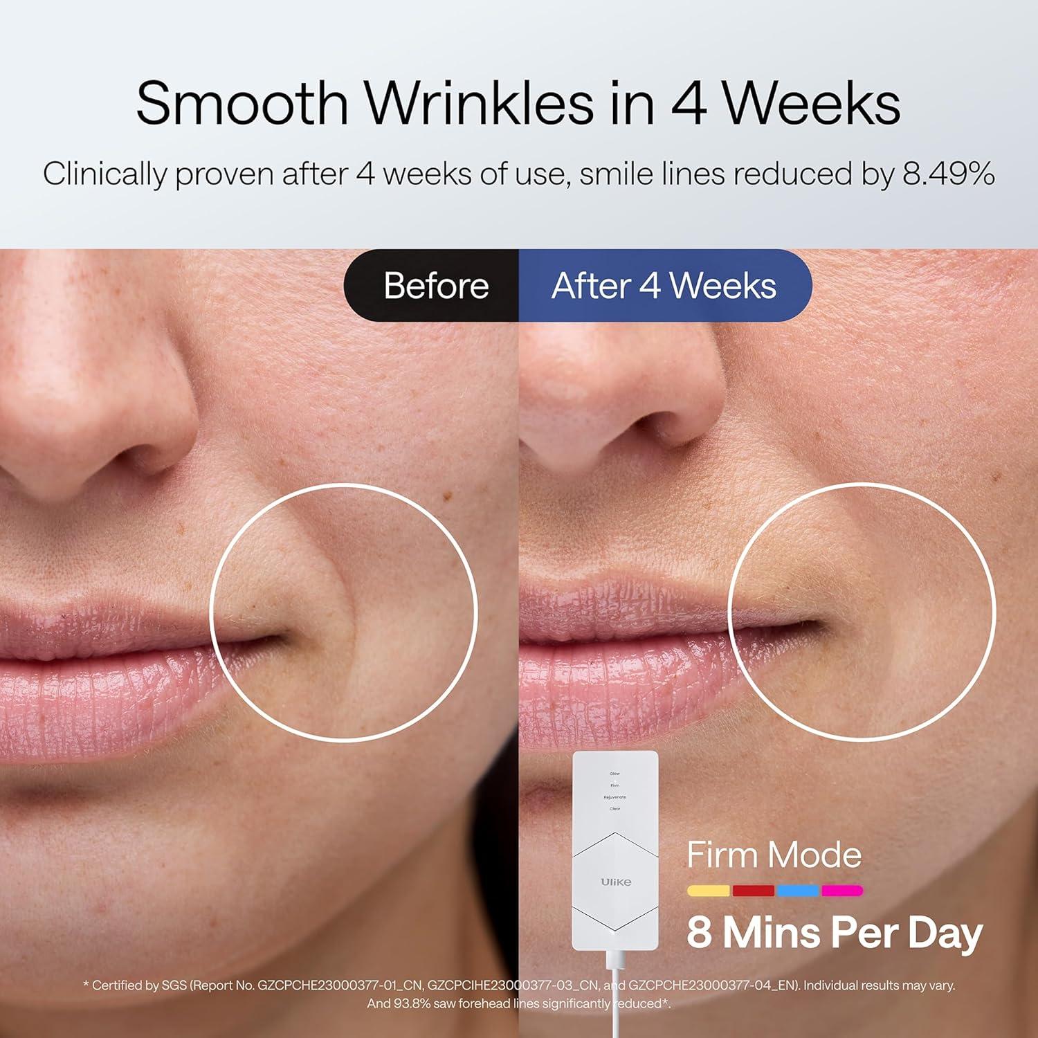 Máscara de Terapia de Luz LED Ulike ReGlow 272 Perlas 100W