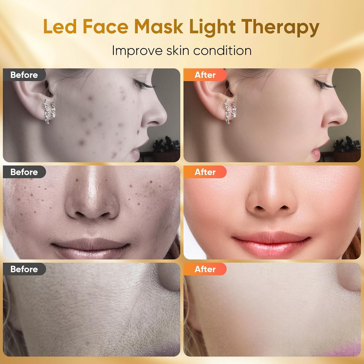 Máscara de Terapia de Luz Roja DZAVOK - 400 LEDs, 7 Modos