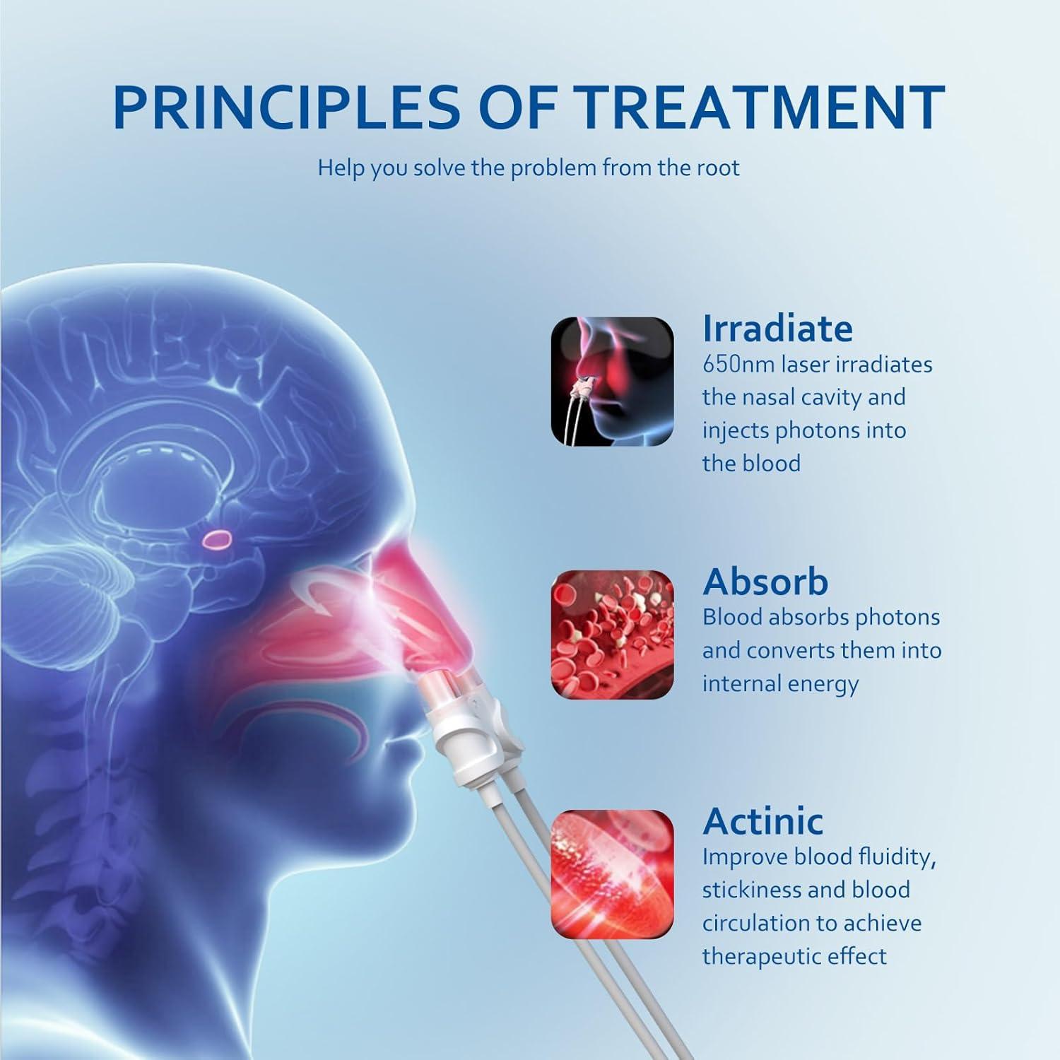 Dispositivo de Terapia Nasal de Luz Roja LASEPREHT 650nm