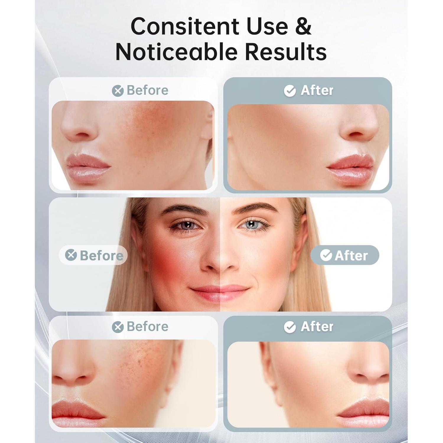 Masajeador Facial de Luz Roja Baihui MJ-400 7 Colores