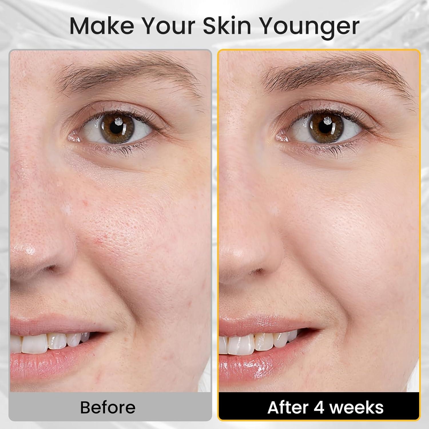 Máscara de Luz LED Iarha para Cara - Terapia de Luz Roja 4 Colores