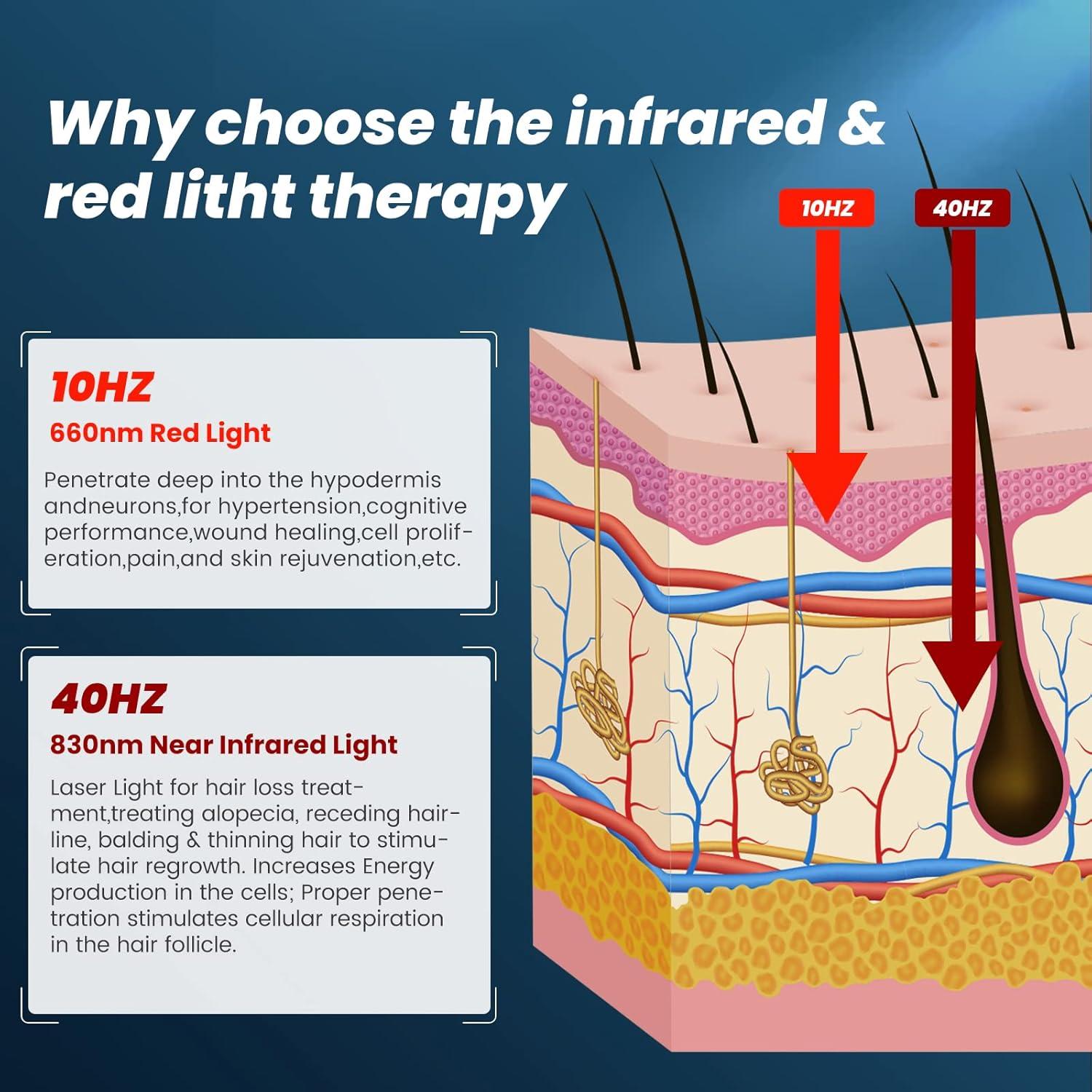 Gorro de Terapia de Luz Roja Elfeye para Crecimiento Capilar